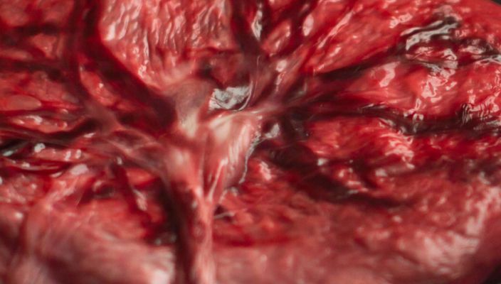 Capa da publicação Direito sobre a placenta: escolha da mulher