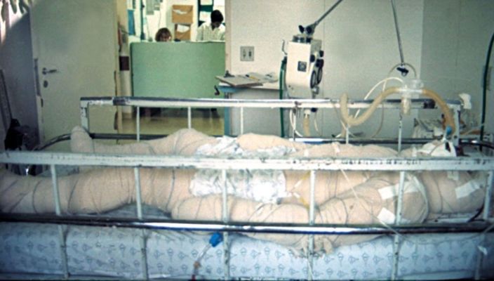 Capa da publicação Índio pataxó queimado: parecer de Damásio de Jesus