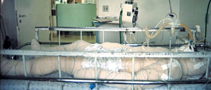 Capa da publicação Índio pataxó queimado: parecer de Damásio de Jesus